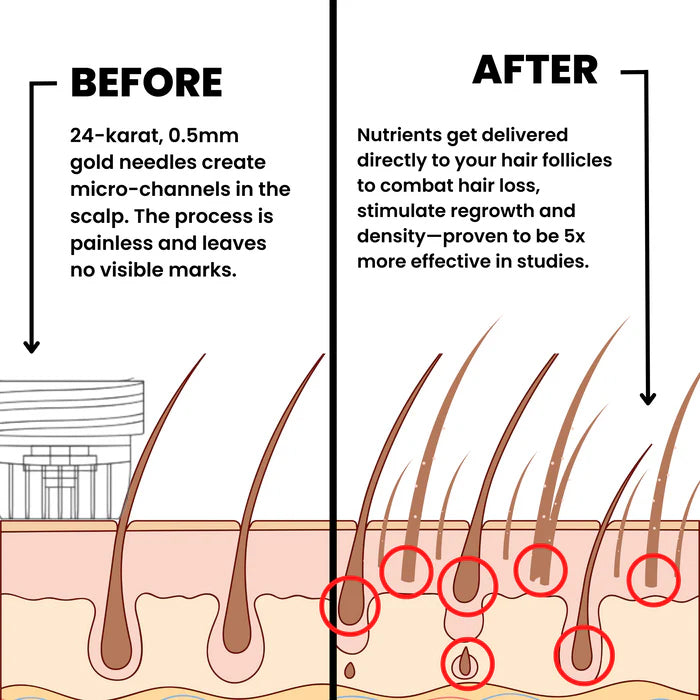 Louxlue™ Hair Regrowth System